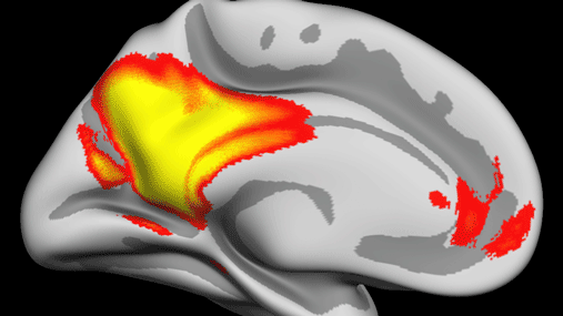 Illustrasjon av en oppblåst hjerne, hvor markerte områder viser hvilke områder av hjernebarken som er involvert i å gjenhente levende minner og fremtidsforestillinger.