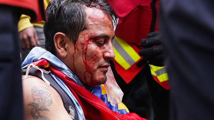 Demonstrant med blødende sår i hode