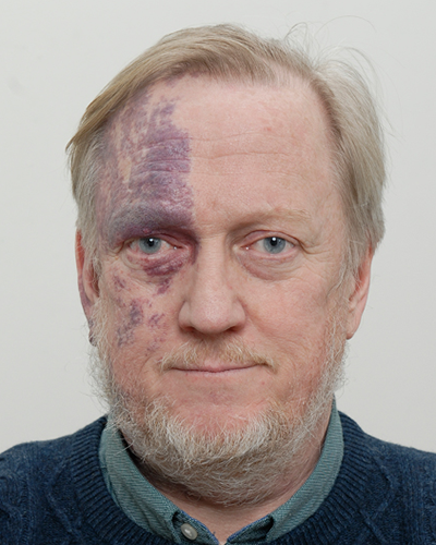Portrett av Dag Harald Claes